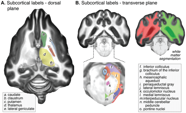 dog brain